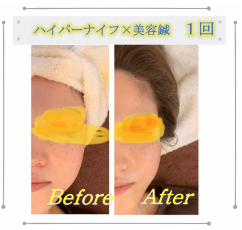 アピール写真