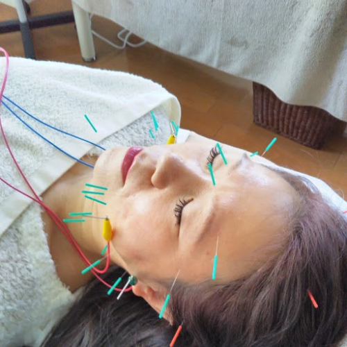 アピール写真