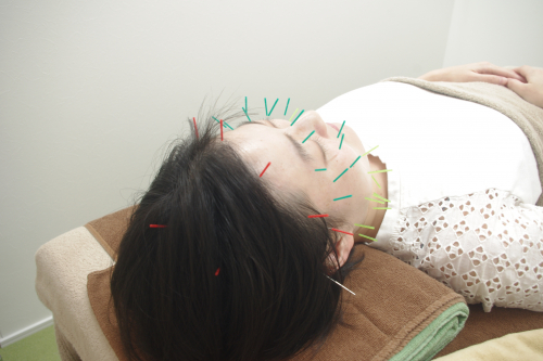 愼命堂鍼灸院のこだわりポイント