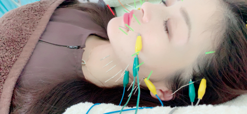 アピール写真