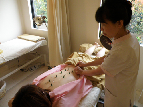 鍼灸仲町台治療院のこだわりポイント