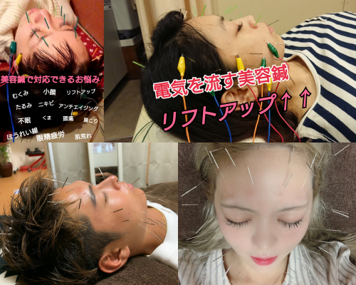 鍼灸・美容鍼サロンKEYAKI　自由が丘院のこだわりポイント
