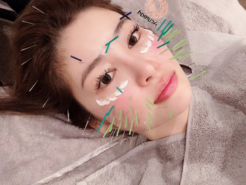 アピール写真