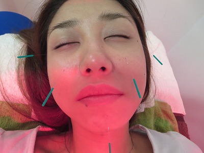 アピール写真