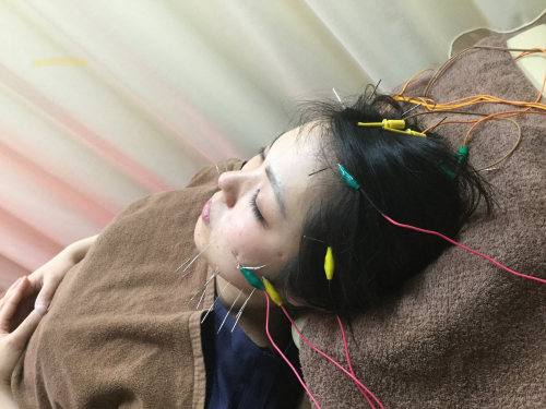 アピール写真
