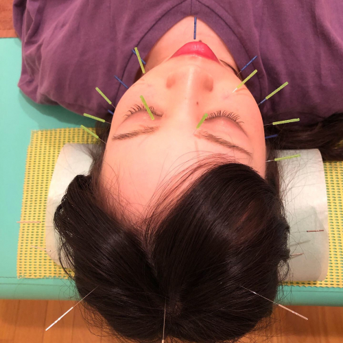 栗木台鍼灸接骨院のこだわりポイント