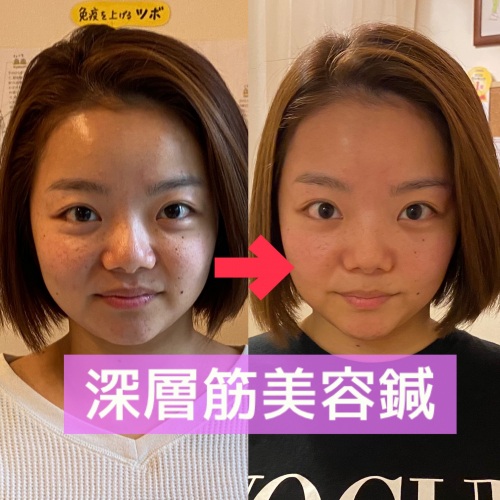 アピール写真