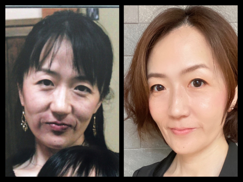 アピール写真