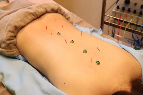 ハリプラス鍼灸院のこだわりポイント