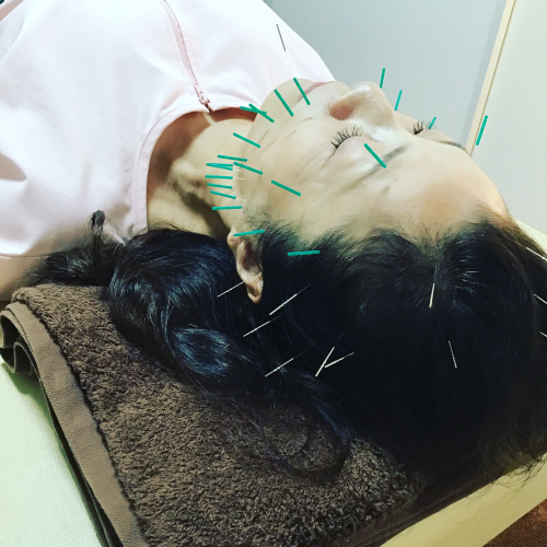 こころ横浜中央鍼灸治療院のこだわりポイント