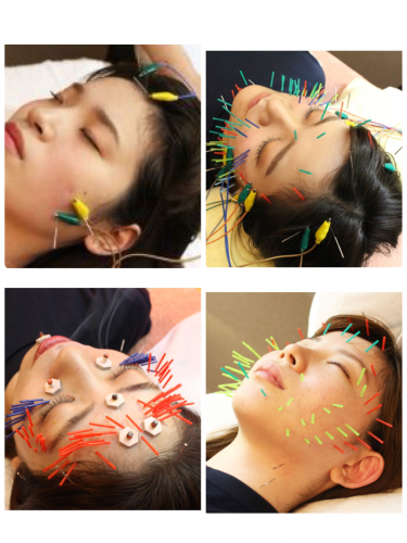 名駅せんが鍼灸院のこだわりポイント