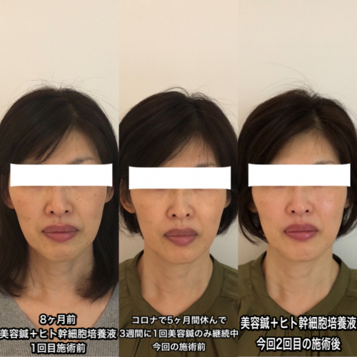 福井市 美容鍼灸 整体サロン 一生美健鍼灸院 福井 芦原 永平寺の鍼灸院