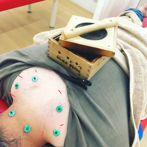 むさし鍼灸整骨院　石坂院のこだわりポイント