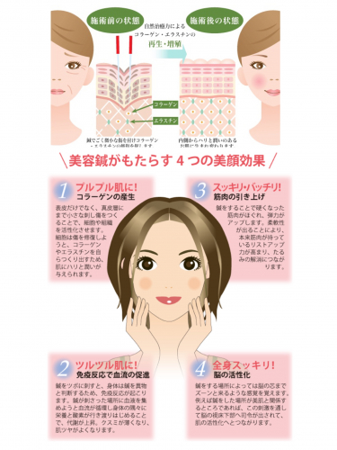 アピール写真