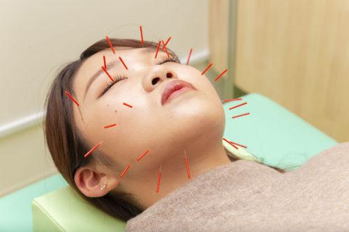 野本鍼灸整骨院　東十条院のこだわりポイント