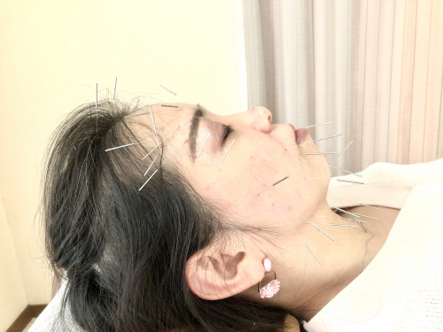 アピール写真