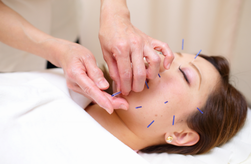 みのり鍼灸治療院のこだわりポイント