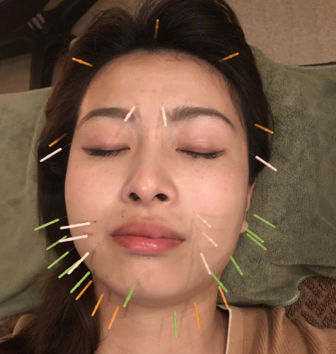 Acupuncture salon LINOA リノア鍼灸院のこだわりポイント