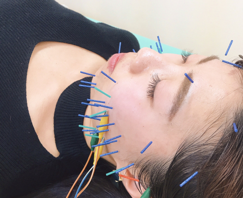 豊橋ふたば接骨院・鍼灸院のこだわりポイント