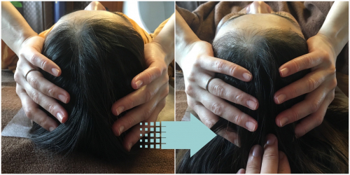 鍼灸院 叶 〜kanai〜のこだわりポイント