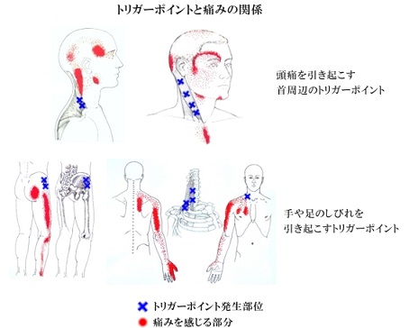 サカイ鍼灸院のこだわりポイント