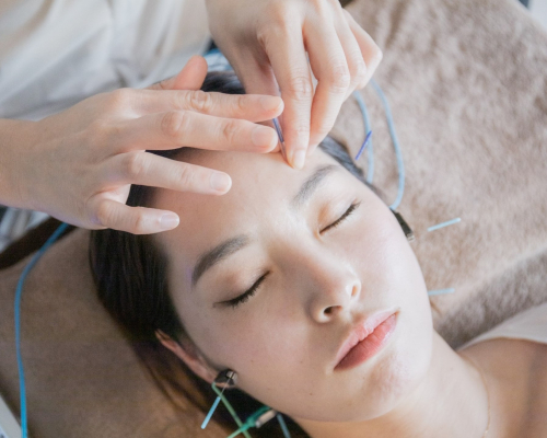 HariFa鍼灸院　名古屋院のこだわりポイント