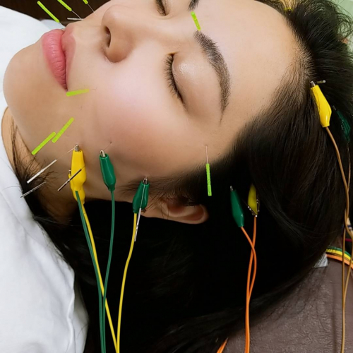 ろはす接骨院・はりきゅう院のこだわりポイント