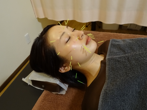 鍼灸院ホワイトリーフのこだわりポイント