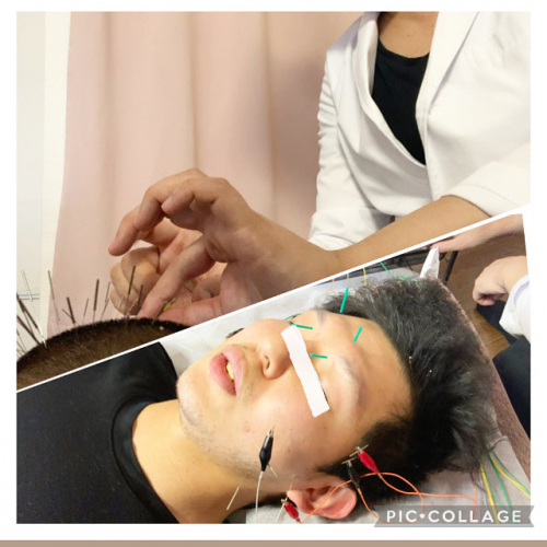 アピール写真