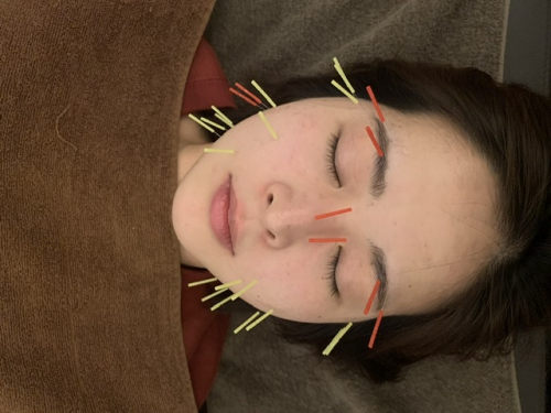 鍼灸サロン-aiwa-のこだわりポイント