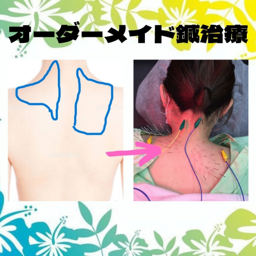 アピール写真