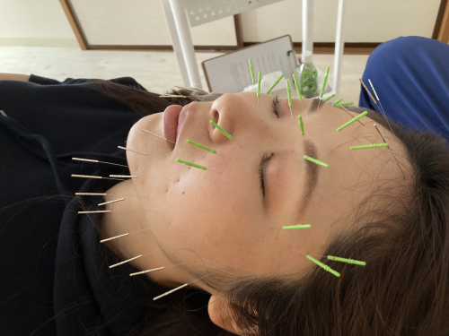 アピール写真