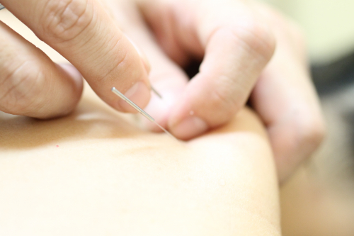 縁里庵かつもと鍼灸院のこだわりポイント