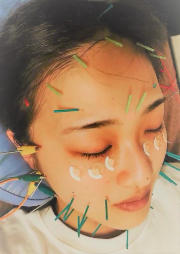 アピール写真