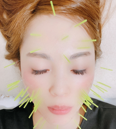 アピール写真