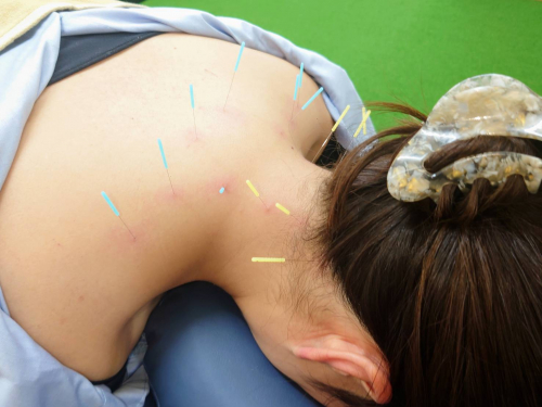 野畑鍼灸マッサージ舎のこだわりポイント