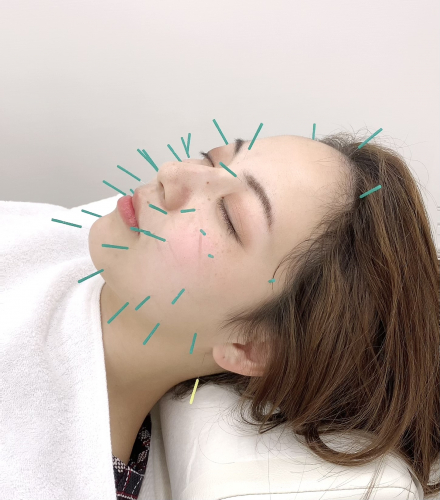 アピール写真