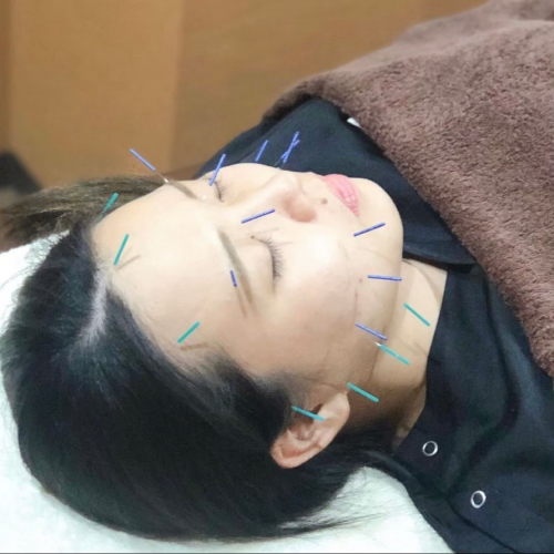 美浜鍼灸接骨院のこだわりポイント