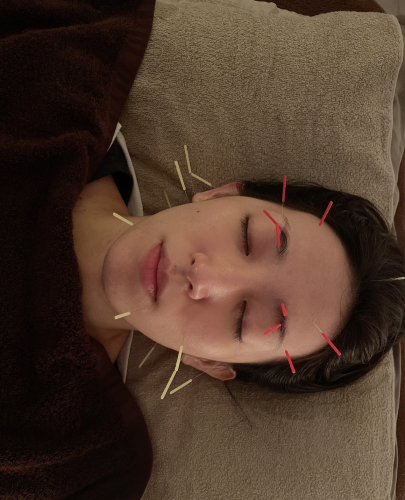 女性専用美容鍼灸サロンLupinusのこだわりポイント