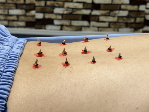 IKKYU〜はり・きゅう・マッサージ〜のこだわりポイント