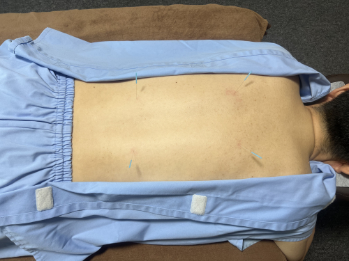 IKKYU〜はり・きゅう・マッサージ〜のこだわりポイント