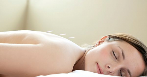 たるみ専門 美容鍼灸 アルバのこだわりポイント