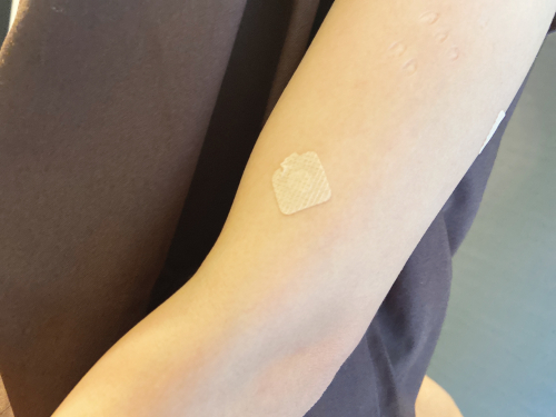 鍼灸サロンRestoreのこだわりポイント