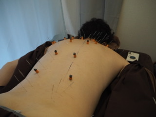 鍼灸＆ボディケアサロン大濠ベッラのこだわりポイント