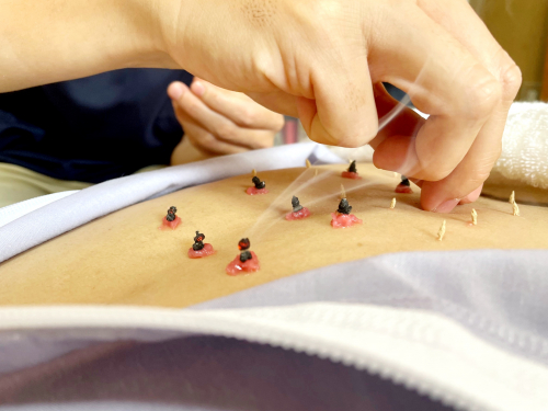 お灸はり院　ともるのこだわりポイント