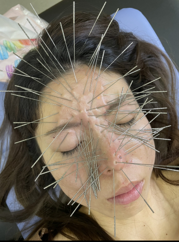 鍼処SHIRAKAWA 浦和院のこだわりポイント