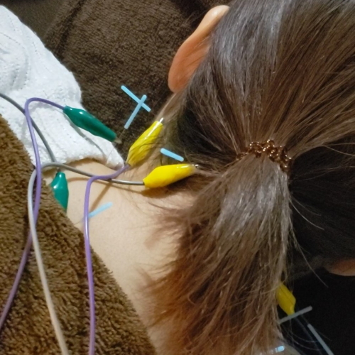 鍼灸サロン 悠雲のこだわりポイント