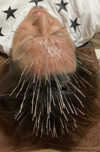 鍼処SHIRAKAWA 浦和院のこだわりポイント