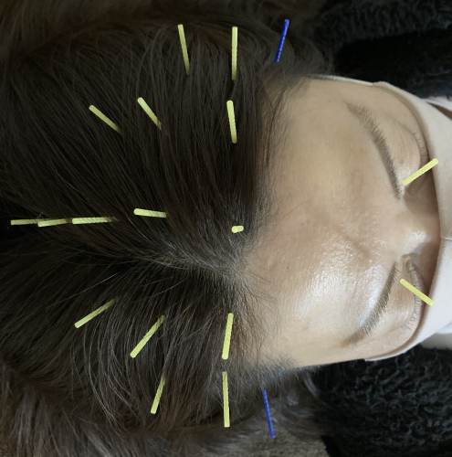 鍼灸院ホワイトリーフのこだわりポイント