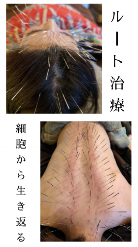 【愛知 ルート治療認定院、美容鍼専門】はりきゅう桂花 (女性専門)のこだわりポイント